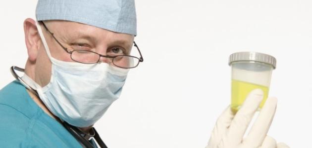 احتباس البول: الأسباب والأعراض وطرق العلاج