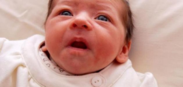 العيوب الخلقية: تعريفها وأسبابها وأنواعها