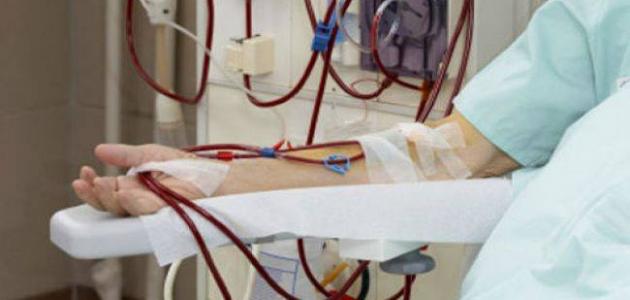 الفشل الكلوي وتأثيره على معدلات الوفاة