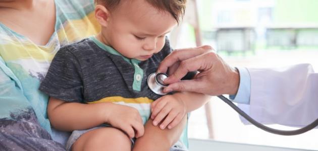 أعراض حمى التيفود لدى الأطفال