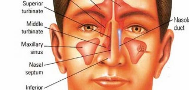 التهاب الجيوب الأنفية: الأسباب والأعراض والعلاج
