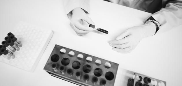 طرق انتقال فيروس السيدا وأعراضه ووسائل الوقاية