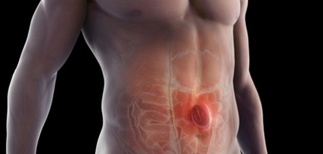 طرق الوقاية من الفتق الإربي وأسبابه
