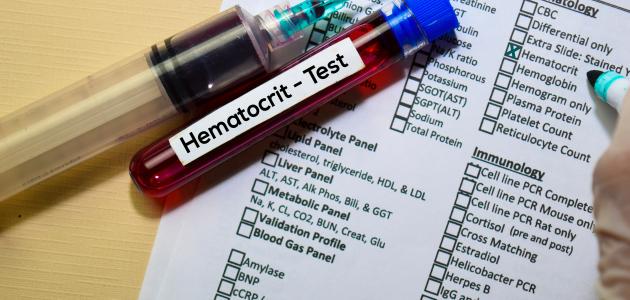 تحليل الهيماتوكريت: تعريفه وأهميته