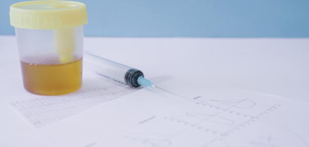 أسباب عدوى المسالك البولية وأعراضها