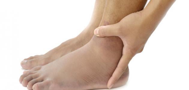 علاج نقص الأملاح في الجسم: الأسباب والأعراض وطرق العلاج