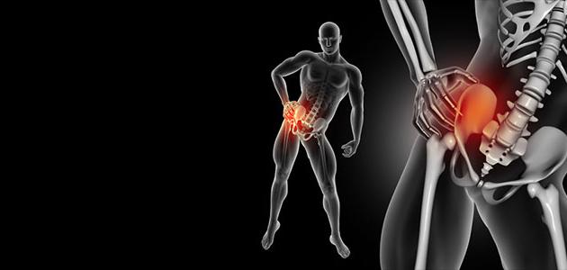 أسباب وعلاج ألم الورك