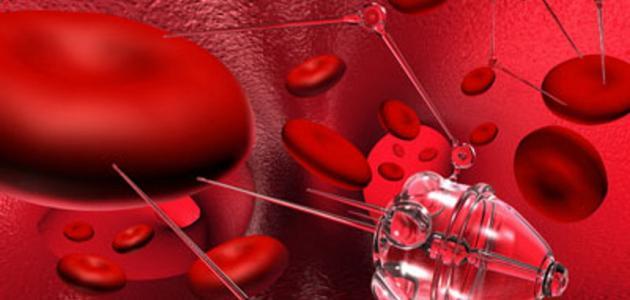 مراحل سرطان الدم وأهم المعلومات حوله