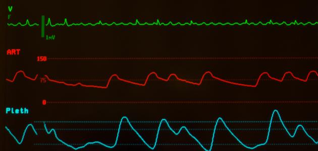 الضغط الشرياني الوسطي: تعريفه وأهميته وطرق حسابه