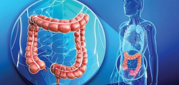 أنواع التهاب القولون وأعراضه