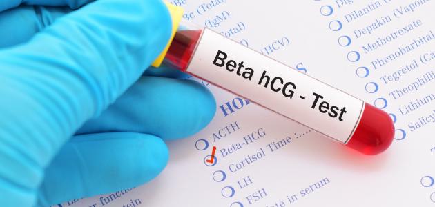 تحليل هرمون الحمل: كل ما تحتاج معرفته