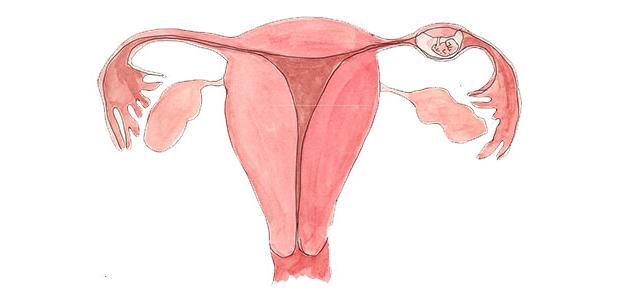 الحمل في قناة فالوب: الأسباب والعوامل والعلاج