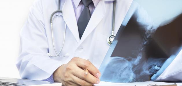 ألم العظام: الأسباب والأمراض المرتبطة