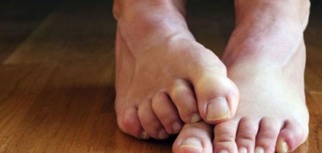 نقص المغنيسيوم في الجسم: الأسباب والأعراض والتوصيات